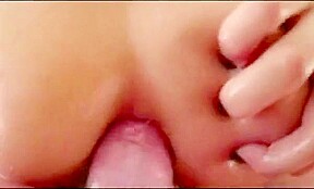 Emergency anal - pmv