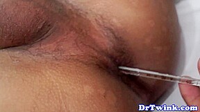 Ethnic doctor plays with twink patients ass