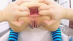 Prolapse Queen