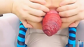 Prolapse Queen