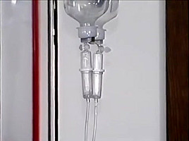 Weekend Catheter
